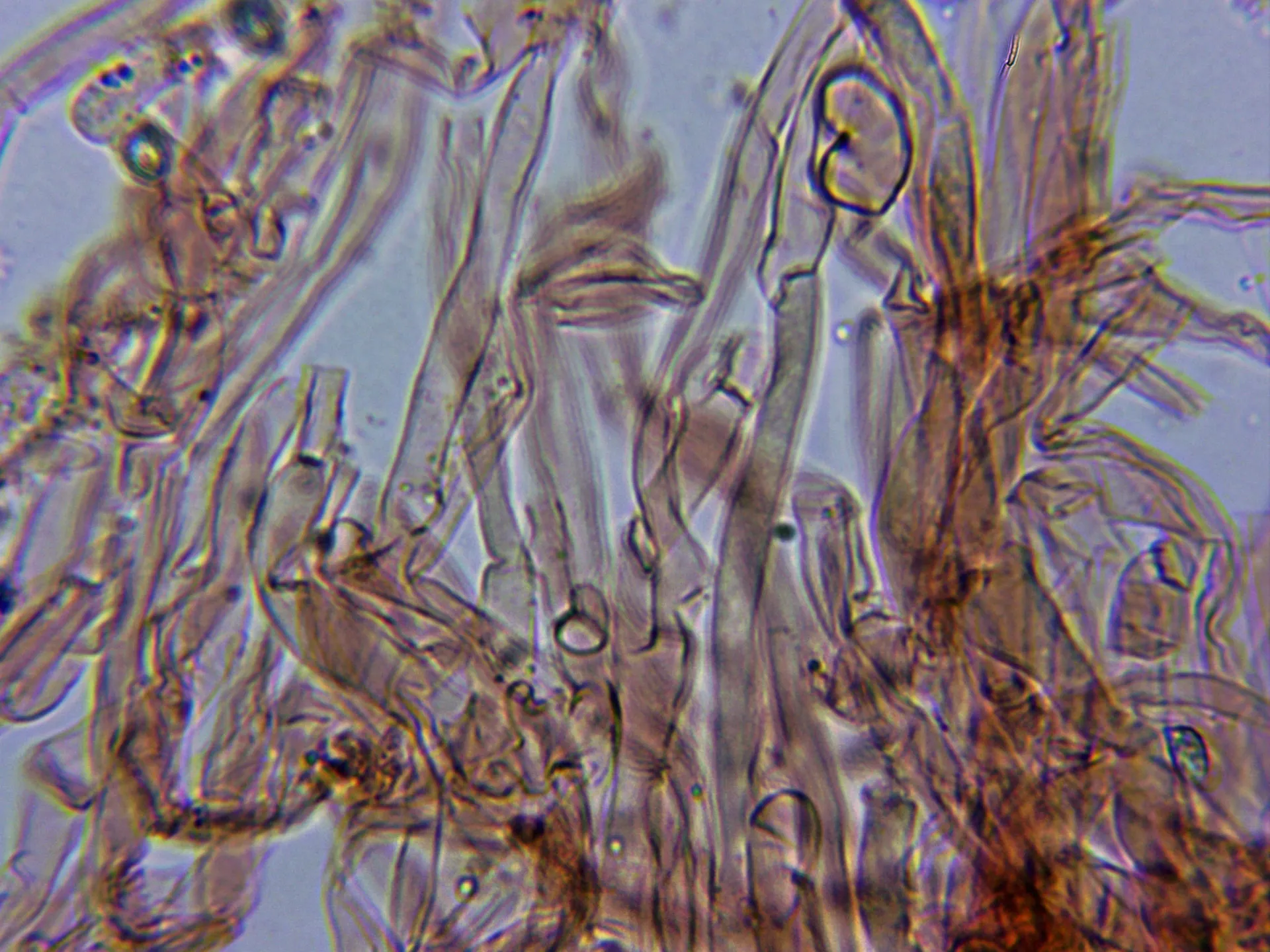 Microscopía de Ramaria gracilis - 11 - Trama monomitica